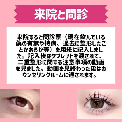 五月@正直レビュー on LIPS 「【水の森で二重埋没した結果📖】カウンセリング予約~術後まで全て..」(4枚目)