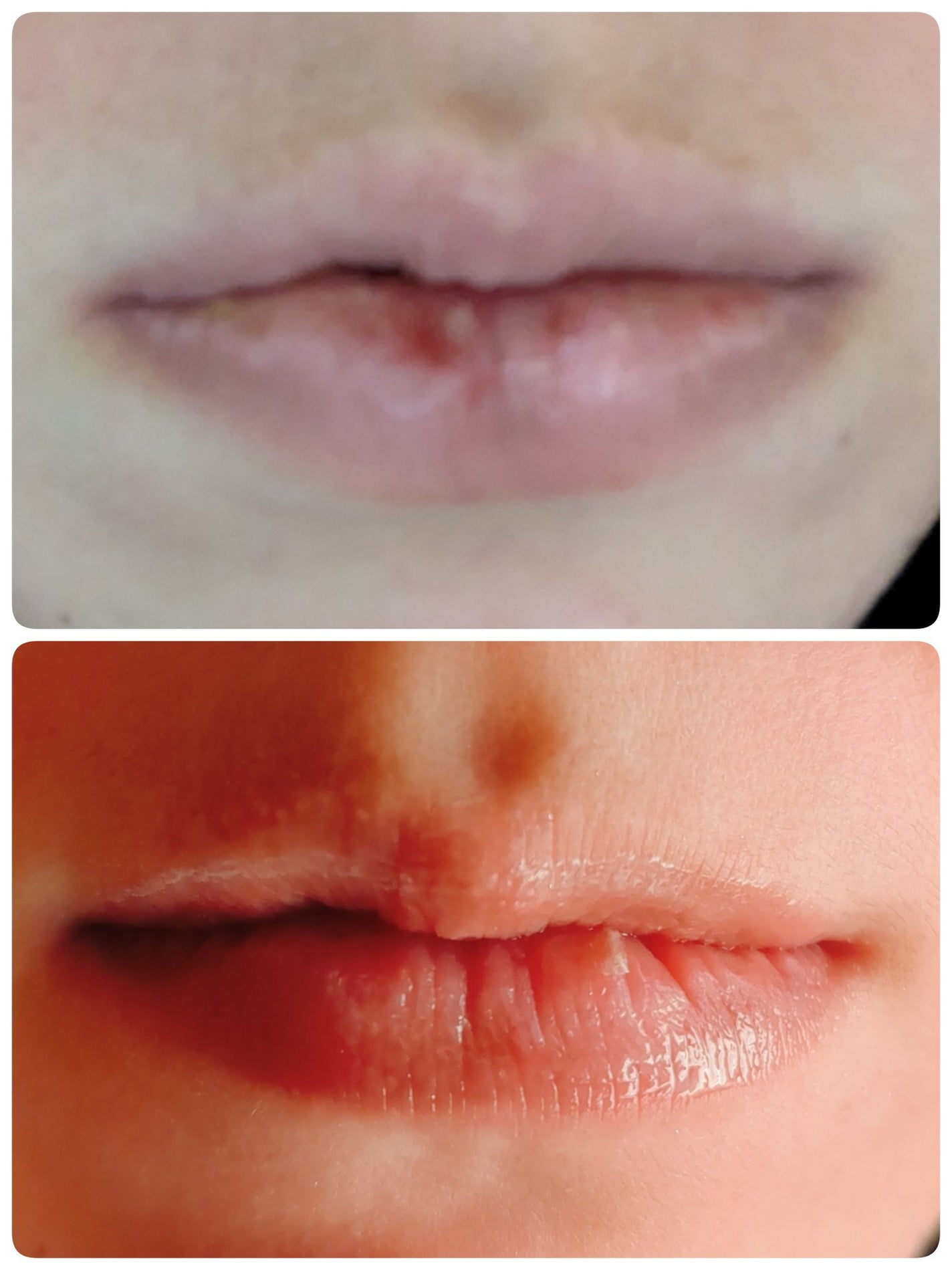 メンソレータム リペアワン 角質ケアリップ/メンソレータム/リップクリームを使ったクチコミ(4枚目)