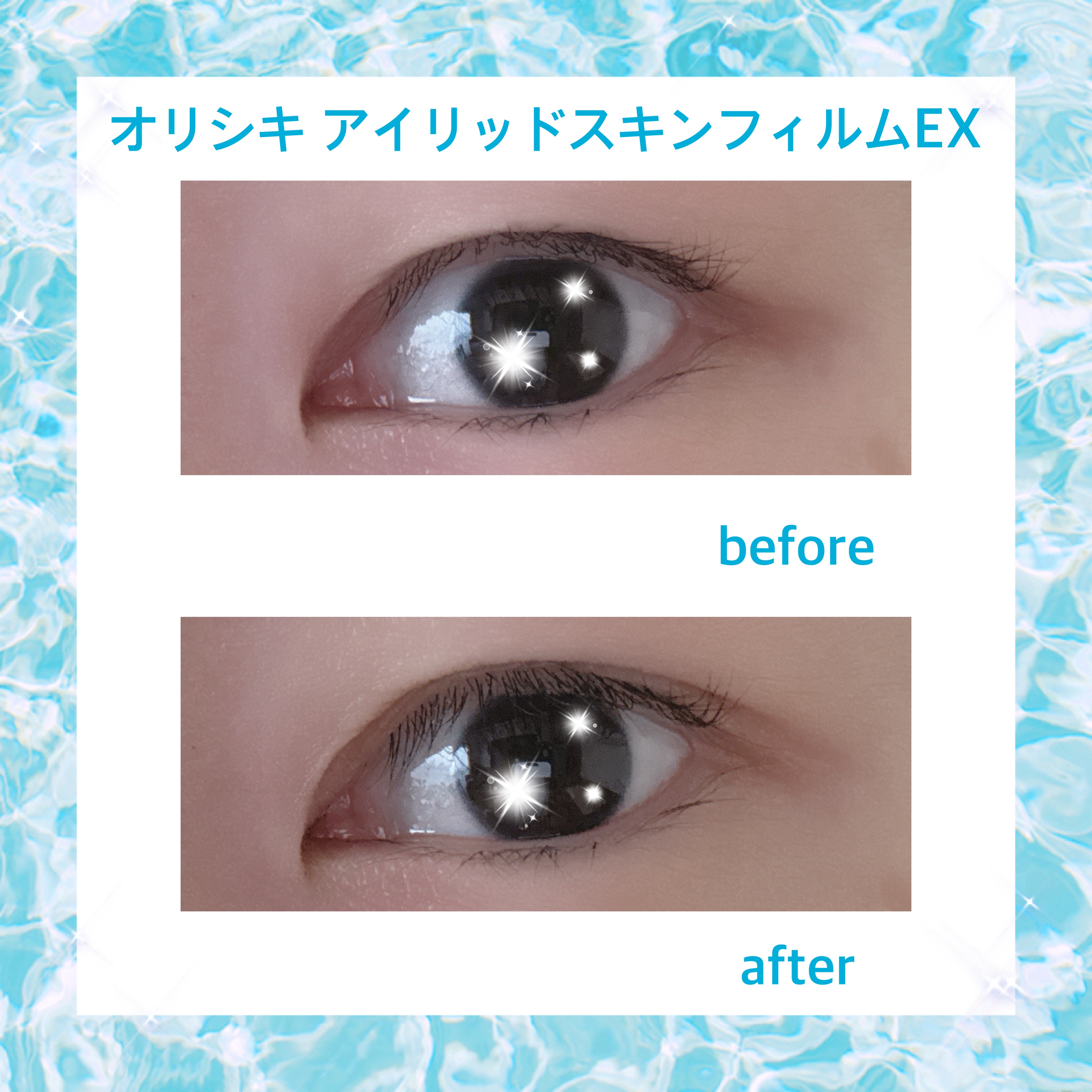 オリシキ アイリッドスキンフィルム EX/D-UP/二重まぶた用アイテムを使ったクチコミ（3枚目）