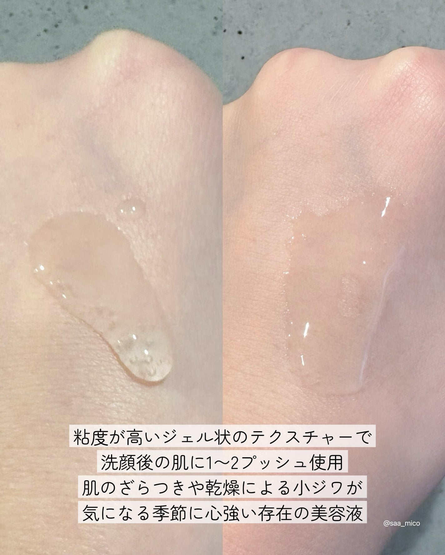 リペアジェル/リソウコーポレーション/美容液を使ったクチコミ(3枚目)