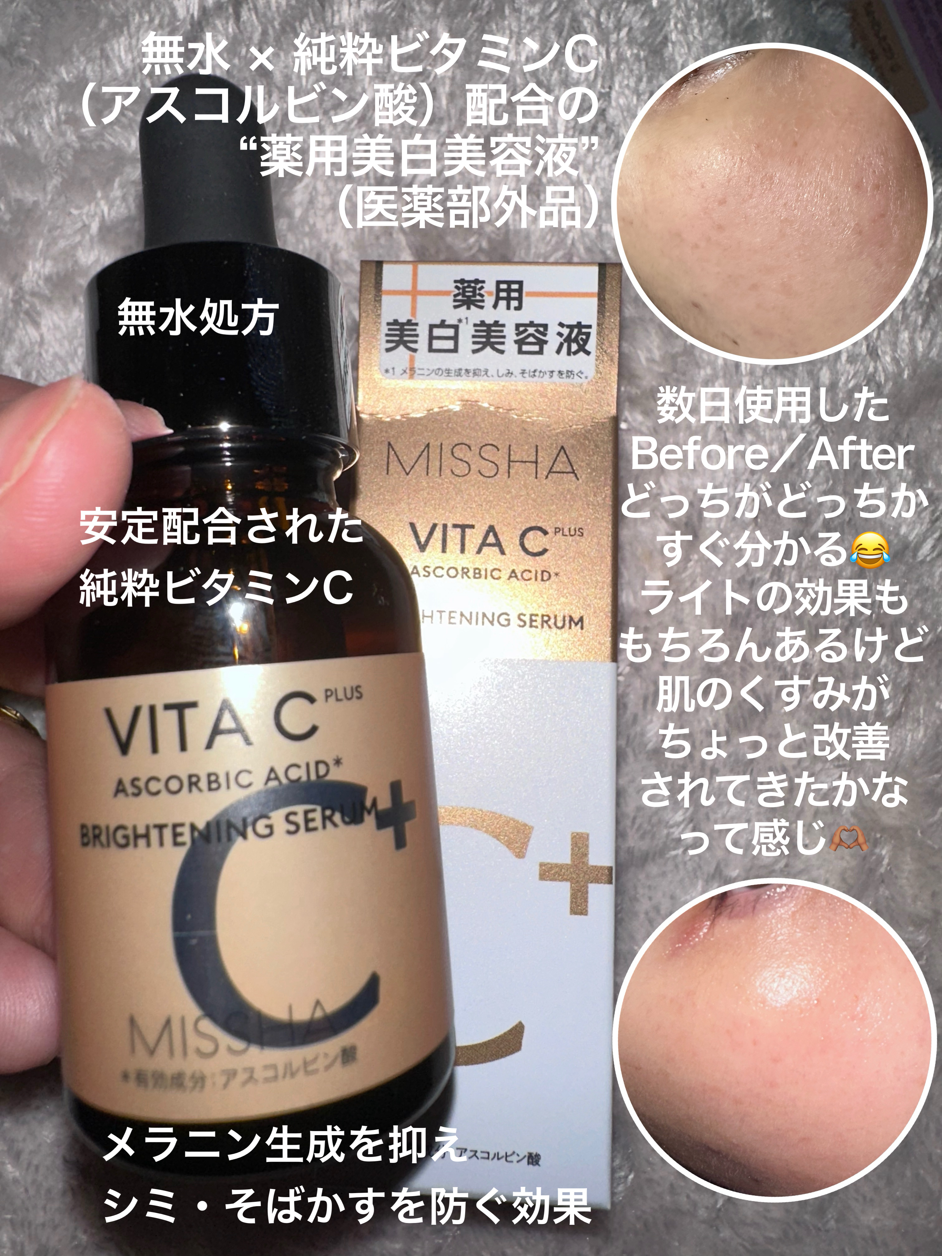 ミシャ ビタシープラス 薬用ブライトニング美容液/MISSHA/美容液を使ったクチコミ（3枚目）