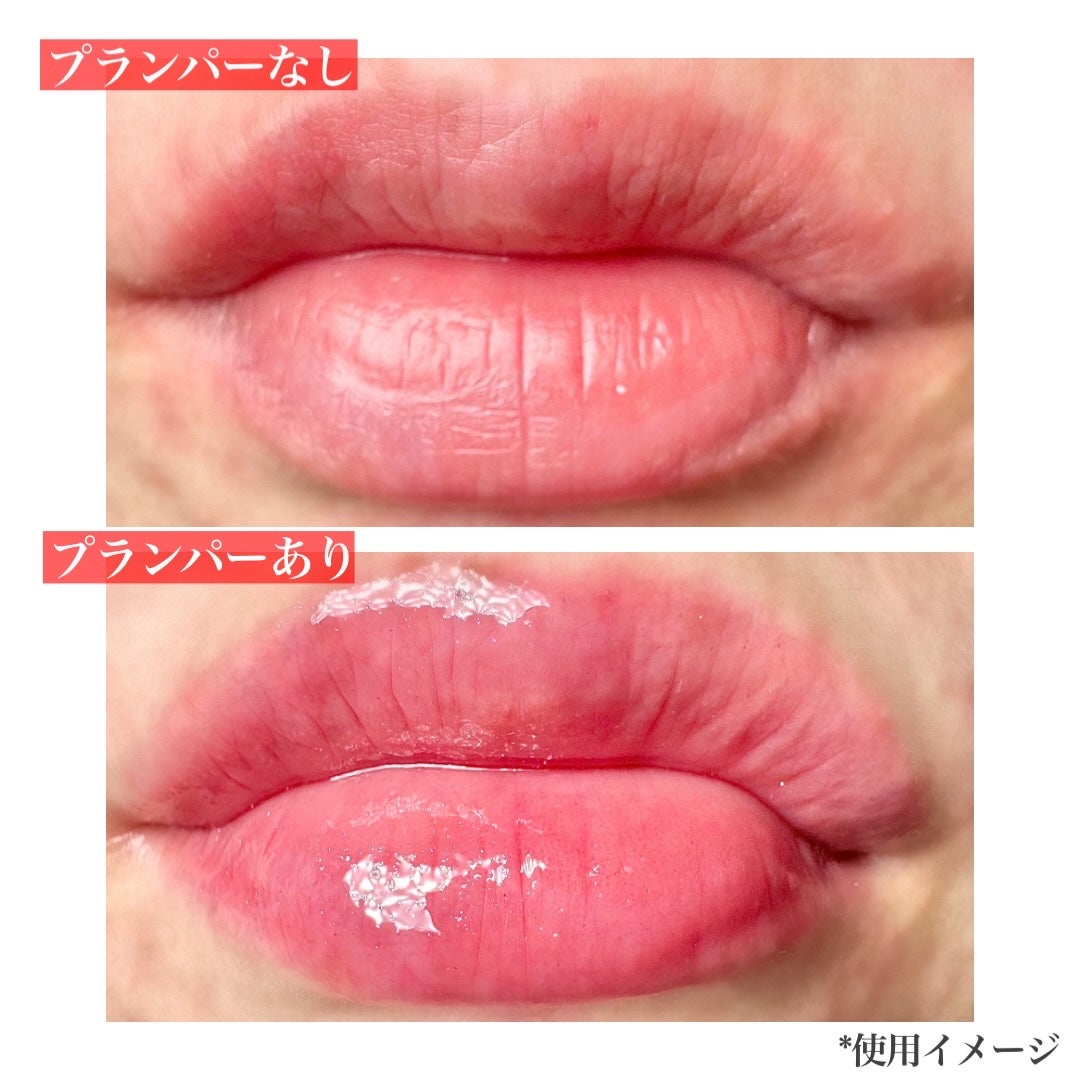 モティブリッププランパー/KAKEHIKI/リッププランパーを使ったクチコミ(5枚目)