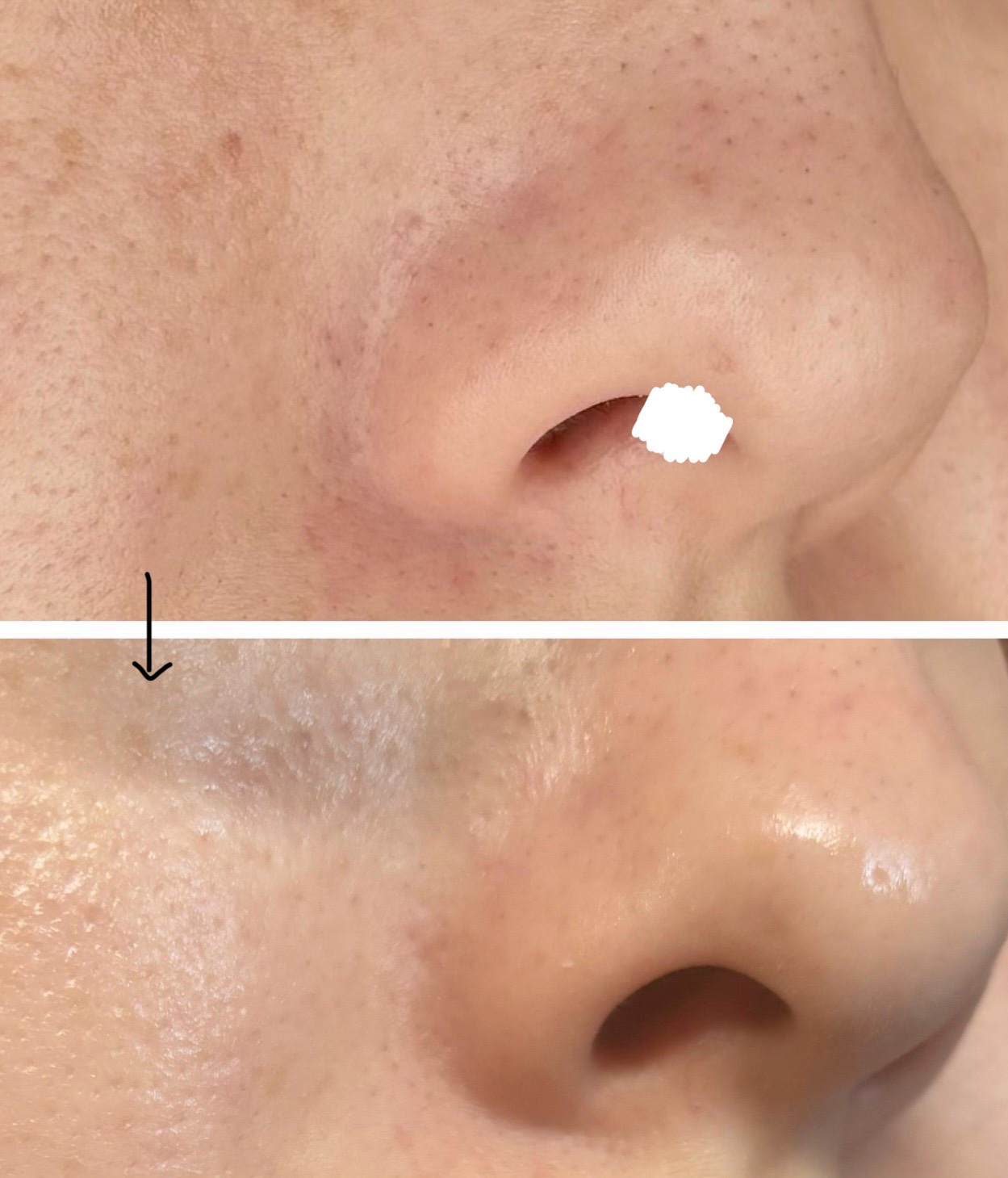 キソ バランシングクリームAZ2/KISO/フェイスクリームを使ったクチコミ（2枚目）