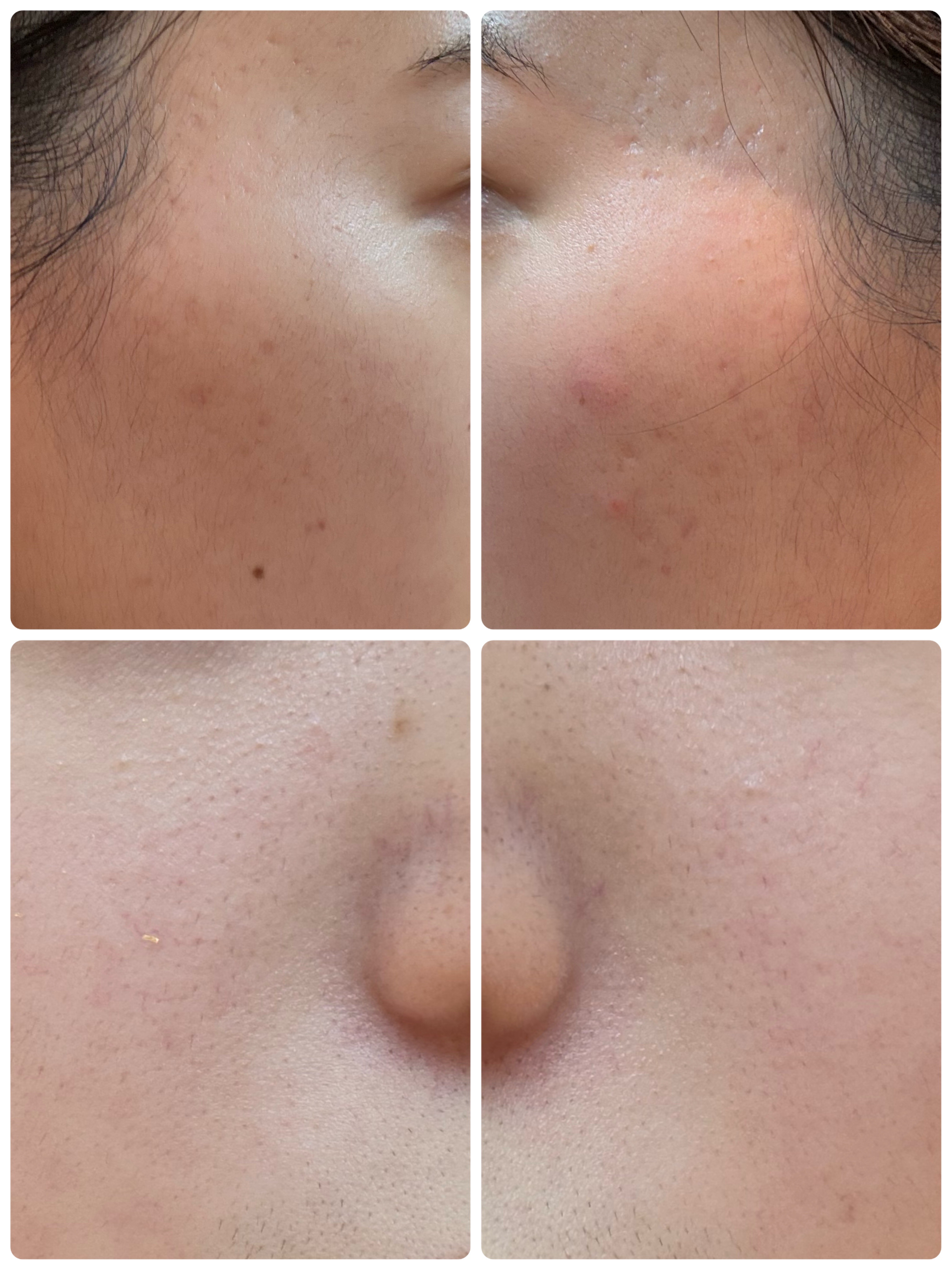 AGE-R ブースタープロ/MEDICUBE/美顔器・マッサージを使ったクチコミ（2枚目）