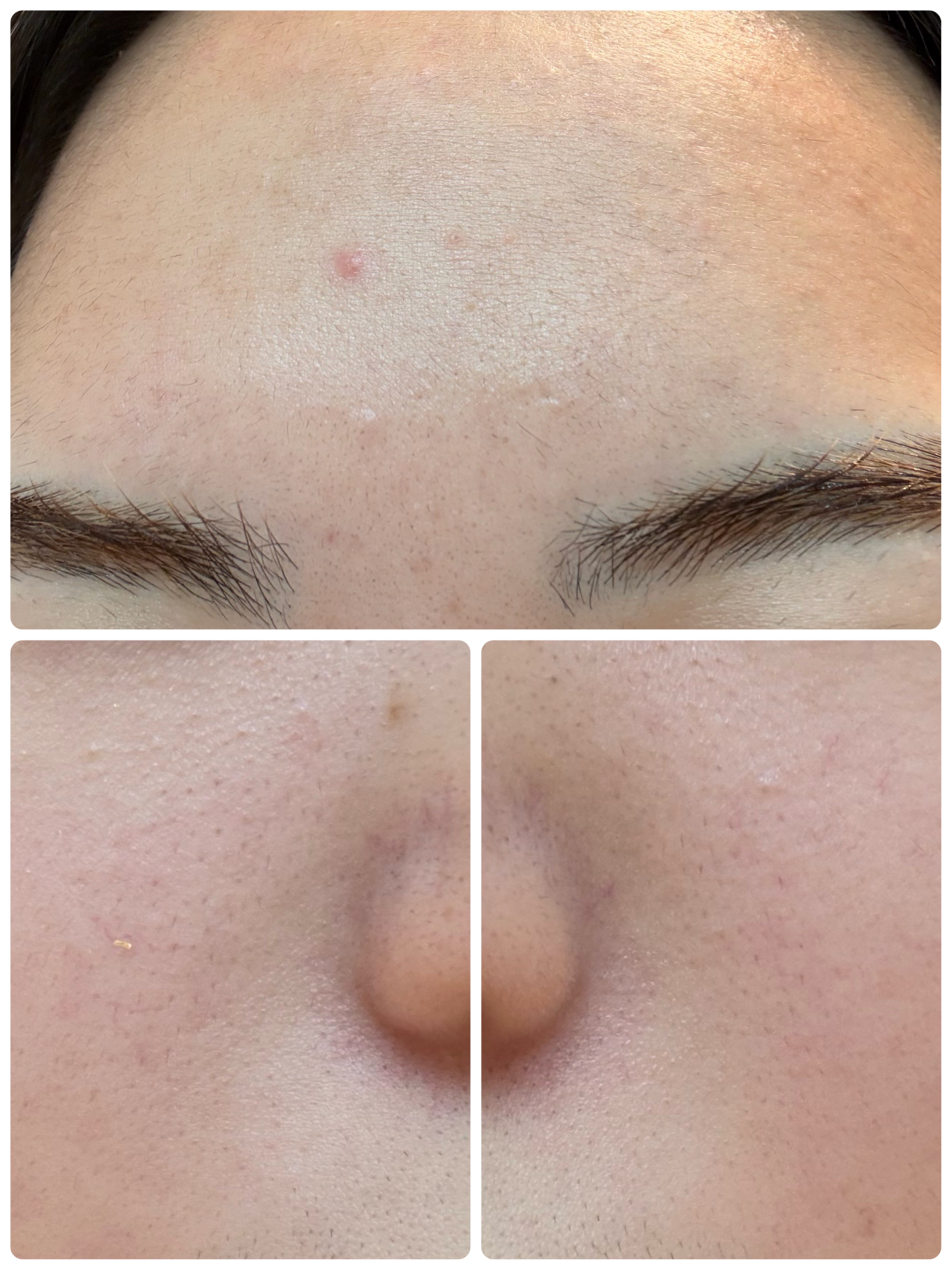 AGE-R ブースタープロ/MEDICUBE/美顔器・マッサージを使ったクチコミ（3枚目）