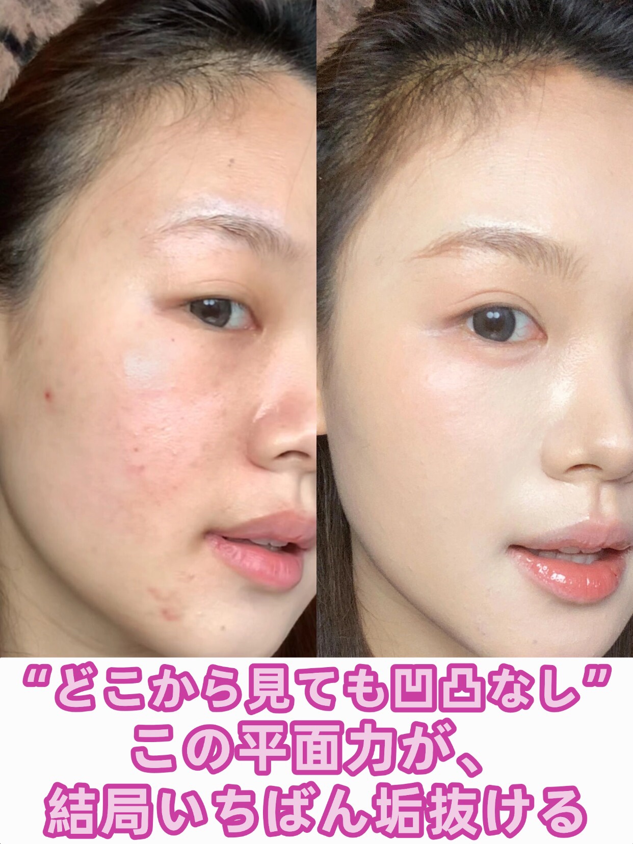 アネトス バランシング トリートメントクリーム/Anetos/フェイスクリームを使ったクチコミ（1枚目）