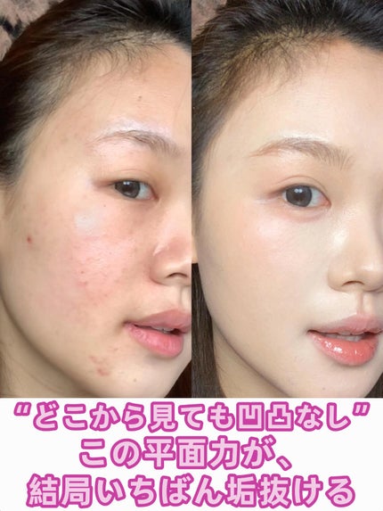 アネトス バランシング トリートメントクリーム/Anetos/フェイスクリームを使ったクチコミ(1枚目)