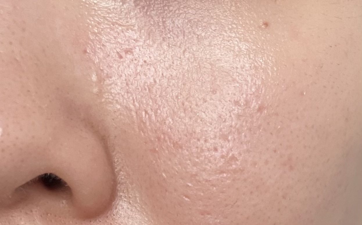 セルメイジング ビタC ブライトニングアンプル/Torriden/美容液を使ったクチコミ（2枚目）