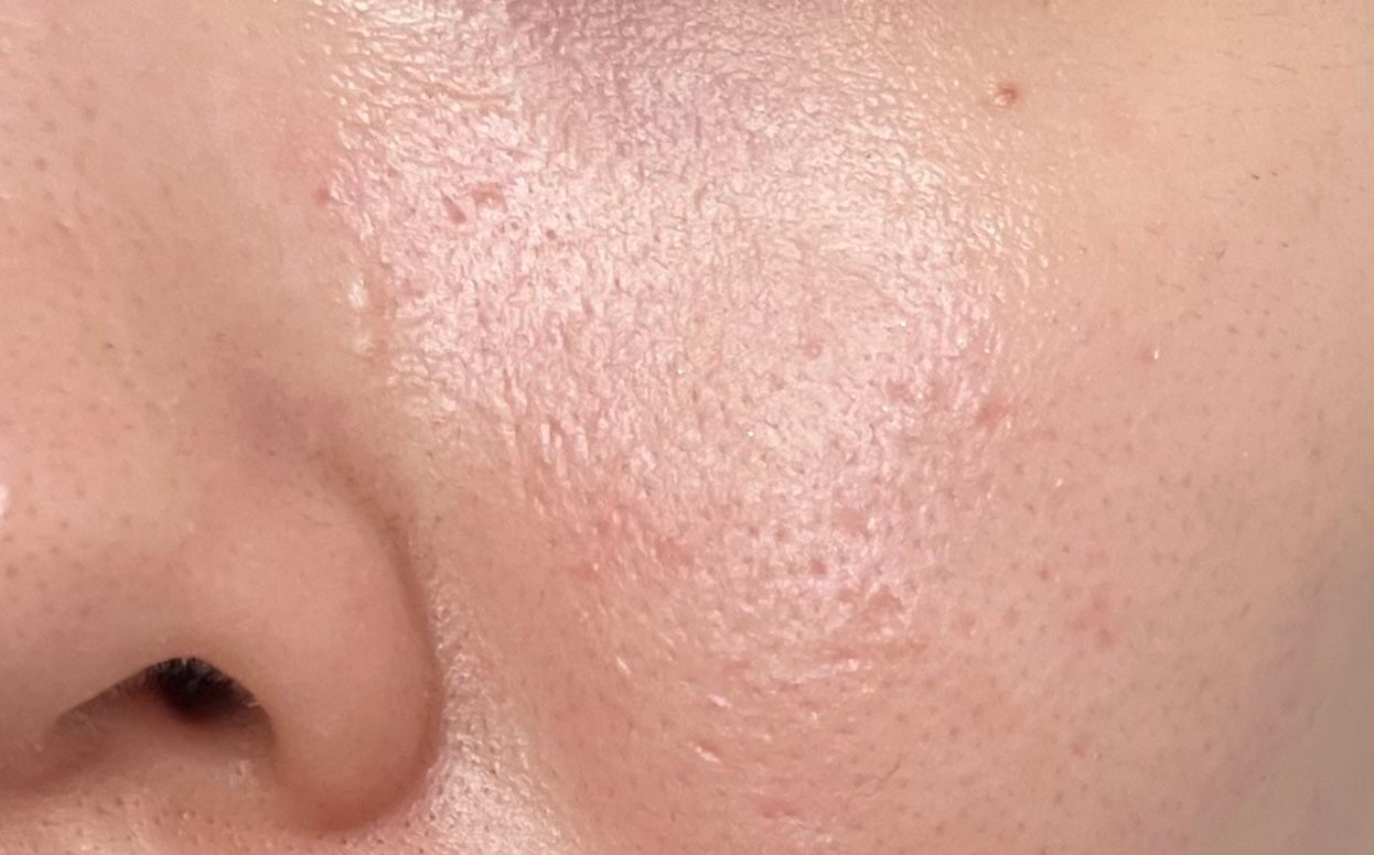 マイルドクレンジング オイル/ファンケル/オイルクレンジングを使ったクチコミ(2枚目)