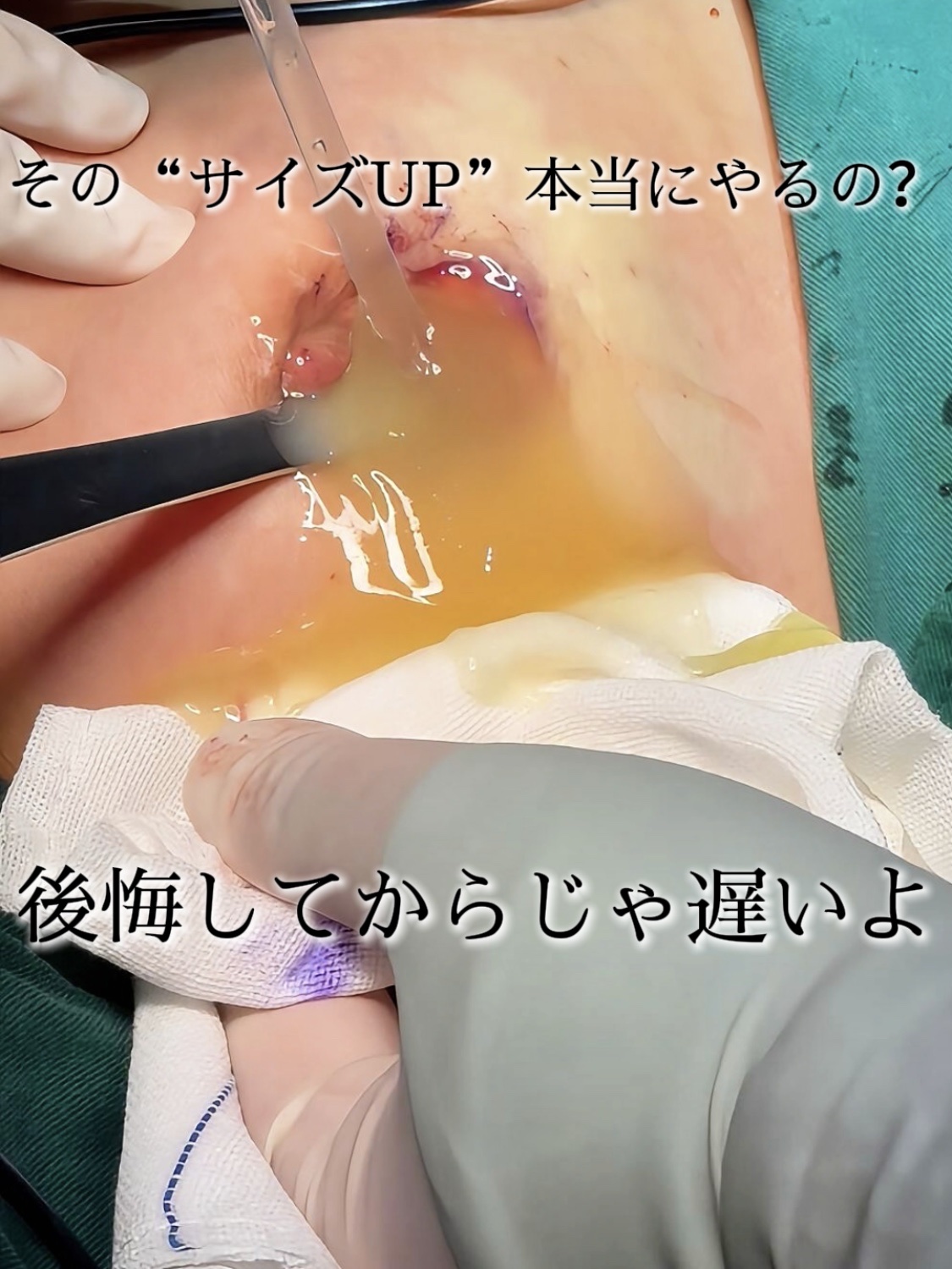 アネトス バランシング トリートメントクリーム/Anetos/フェイスクリームを使ったクチコミ（1枚目）