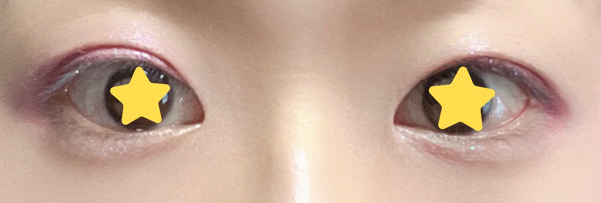 オリシキ アイリッドスキンフィルム EX/D-UP/二重まぶた用アイテムを使ったクチコミ(5枚目)