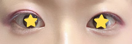 オリシキ アイリッドスキンフィルム EX/D-UP/二重まぶた用アイテムを使ったクチコミ(5枚目)