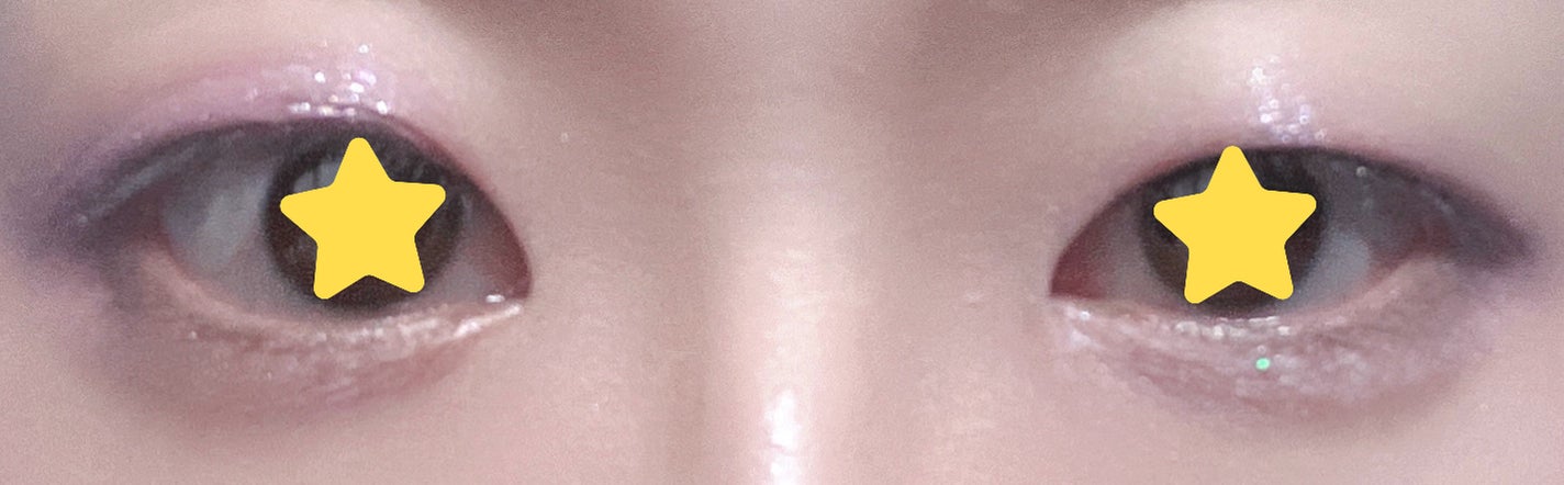 オリシキ アイリッドスキンフィルム EX/D-UP/二重まぶた用アイテムを使ったクチコミ(4枚目)