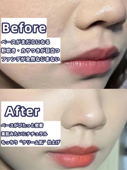 アネトス バランシング トリートメントクリーム/Anetos/フェイスクリームを使ったクチコミ(1枚目)