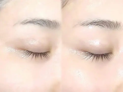 PDRN リフティングマスク/MEDIHEAL/シートマスク・パックを使ったクチコミ（3枚目）