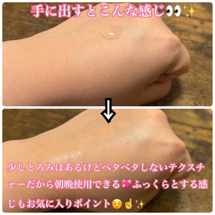 ã€ã³ãžã§ã¹ã¯ NM ïŒïŒïŒïŒïŒ ãã¥ãª ããªãã ã»ã©ã /INJESK/çŸå®¹æ¶²ã䜿ã£ãã¯ãã³ãïŒ5æç®ïŒ