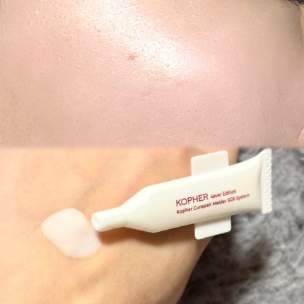 SOSメルダーシステム/KOPHER/フェイスクリームを使ったクチコミ(2枚目)