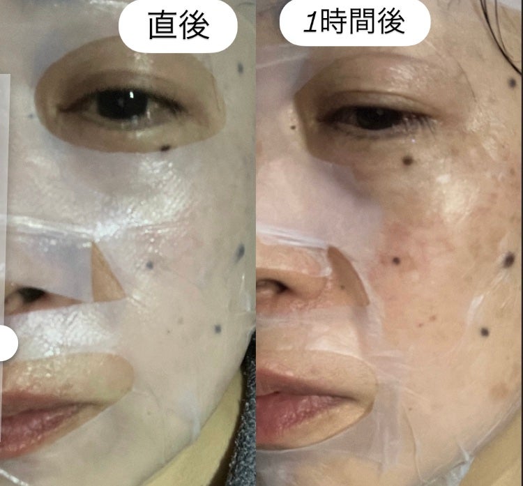 B:VIDインアンドアウトフェイシャルマスク/バイビッド/シートマスク・パックを使ったクチコミ(6枚目)