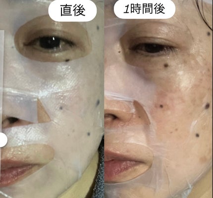 B:VIDインアンドアウトフェイシャルマスク/バイビッド/シートマスク・パックを使ったクチコミ(6枚目)