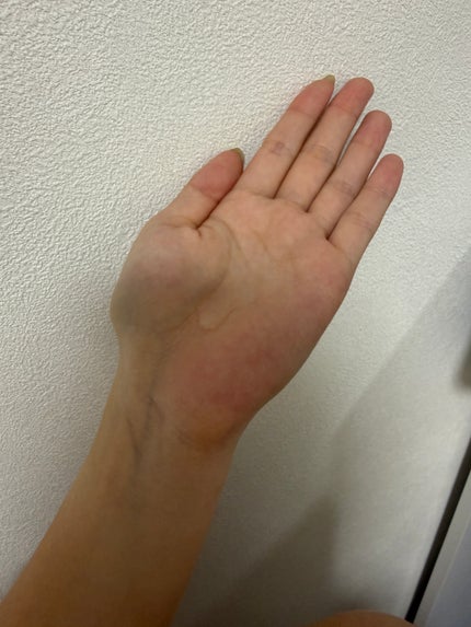 インジェスク NM 10000 デュオ ドリップ セラム/INJESK/美容液を使ったクチコミ(7枚目)