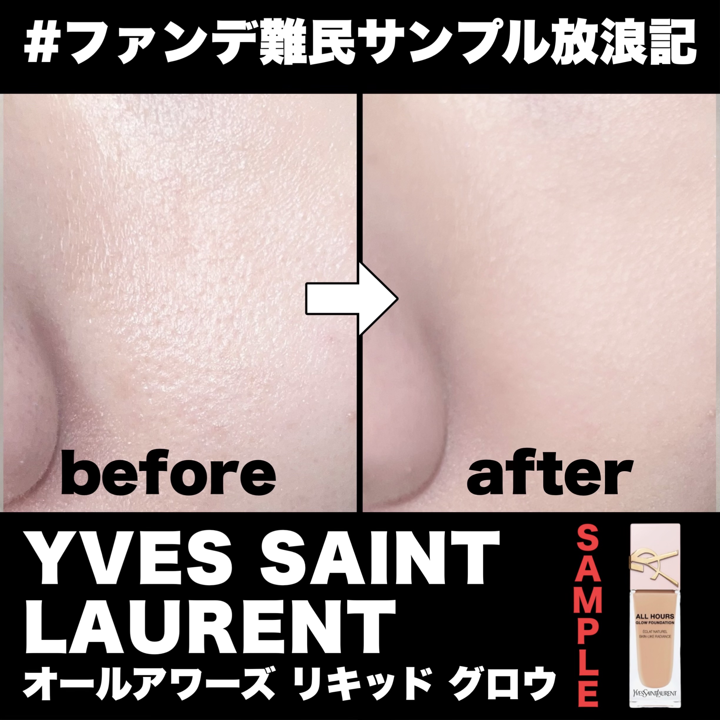 《ファンデ難民シリーズ⑧》

【YVES SAINT LAURENT｜オールアワーズ リキッド グロウ】

現在進行形でファンデ難民です…🥹
いろんなサンプルやミニサイズを片っ端から試してます。
合うファンデが見つかるまでは
　#ファンデ