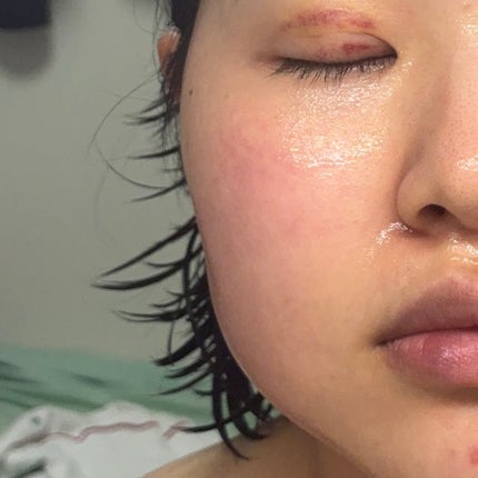 S-EGF エクソソームブーストショット美容液/SISTER ANN/美容液を使ったクチコミ(4枚目)