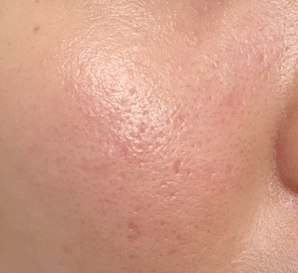 セルメイジング ビタC ブライトニングアンプル/Torriden/美容液を使ったクチコミ(1枚目)