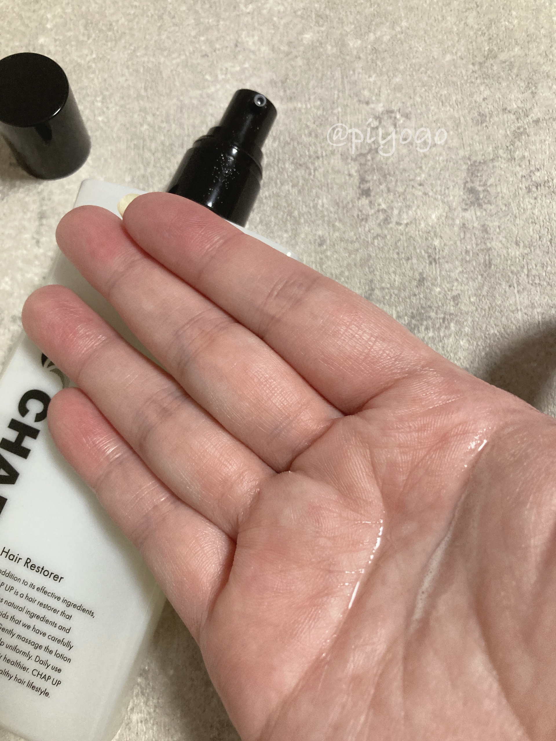 チャップアップ育毛ローション/CHAP UP(チャップアップ)/頭皮ローションを使ったクチコミ（3枚目）