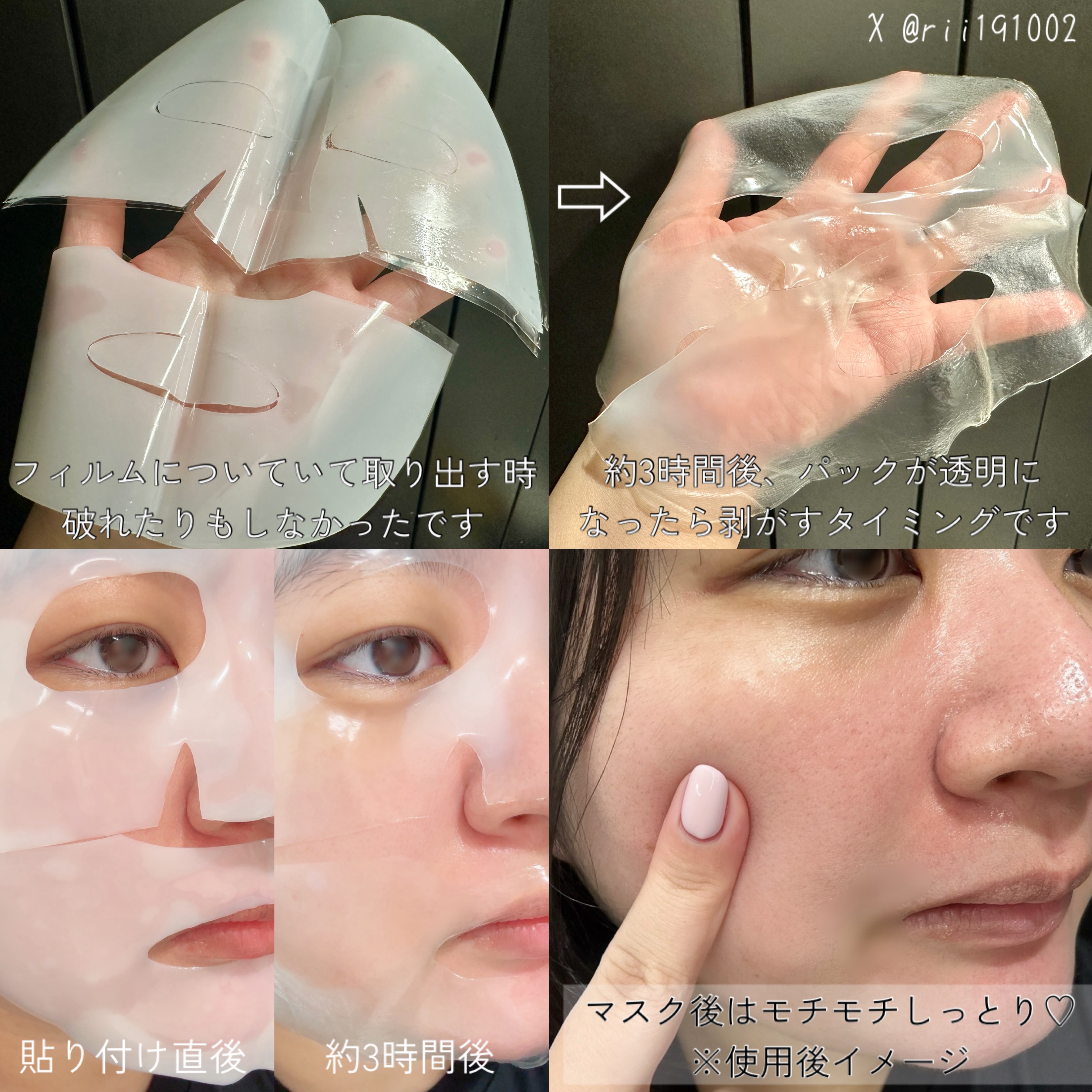 ナノステップ コラーゲン メルティングマスク/from medi+/シートマスク・パックを使ったクチコミ（2枚目）