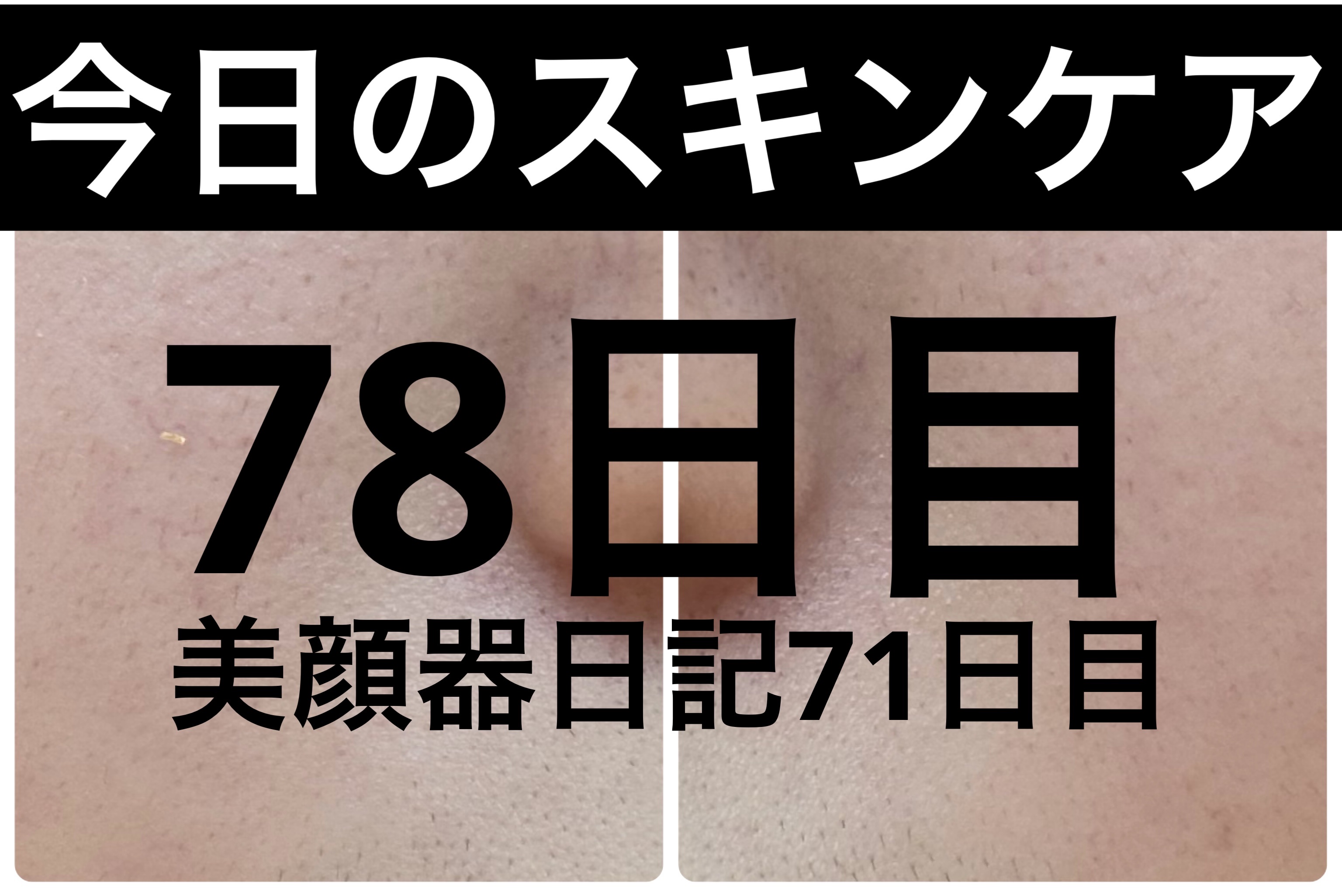 AGE-R ブースタープロ/MEDICUBE/美顔器・マッサージを使ったクチコミ（1枚目）