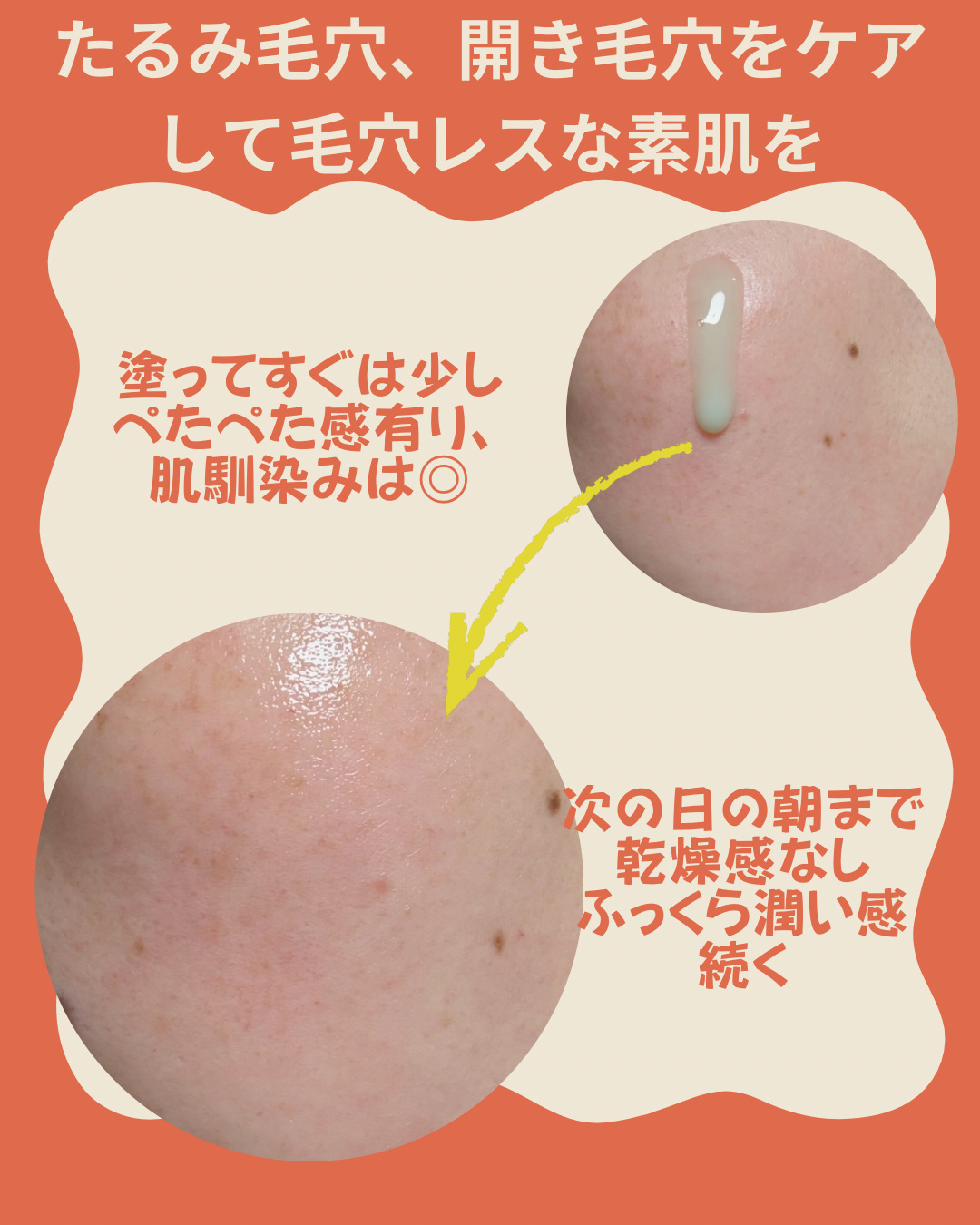 ReDRNエクソソームアンプル/Dr.nineteen/美容液を使ったクチコミ（3枚目）