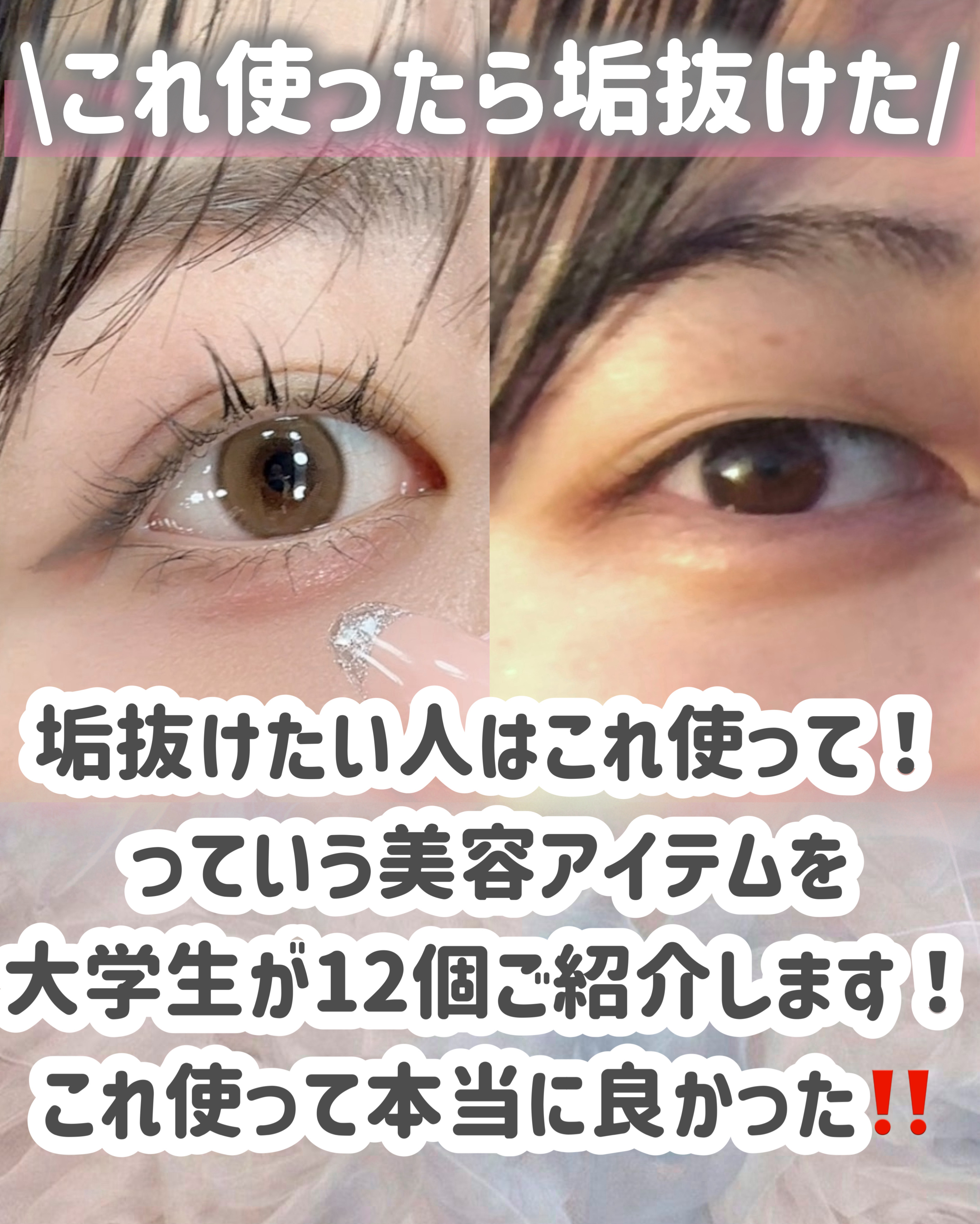 RXザ・ビタミンC23セラム/COSRX/美容液を使ったクチコミ（2枚目）