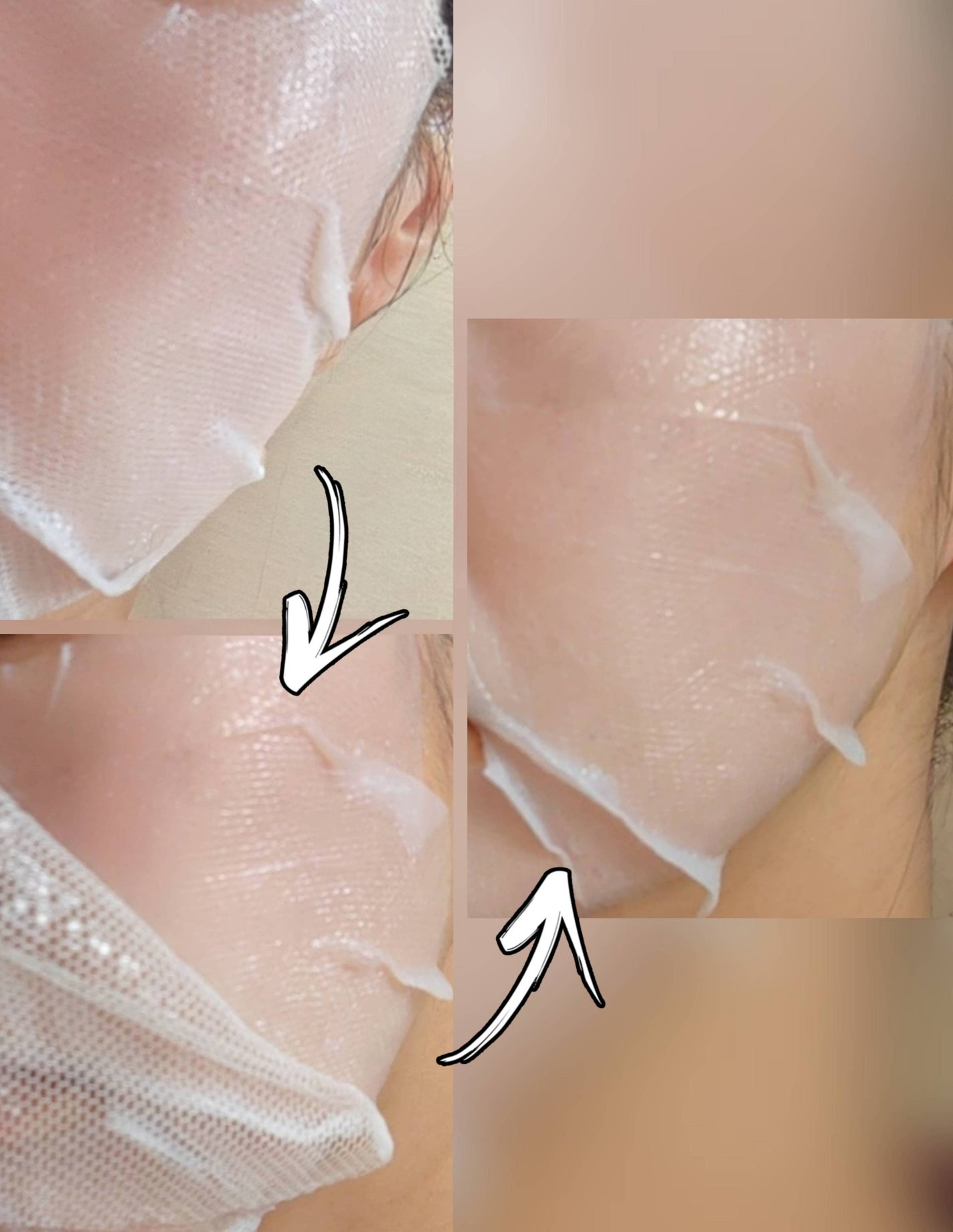 トラブルパッチマスク/EIOM/その他スキンケアを使ったクチコミ(6枚目)