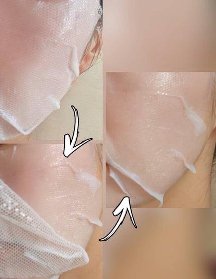 トラブルパッチマスク/EIOM/その他スキンケアを使ったクチコミ(6枚目)