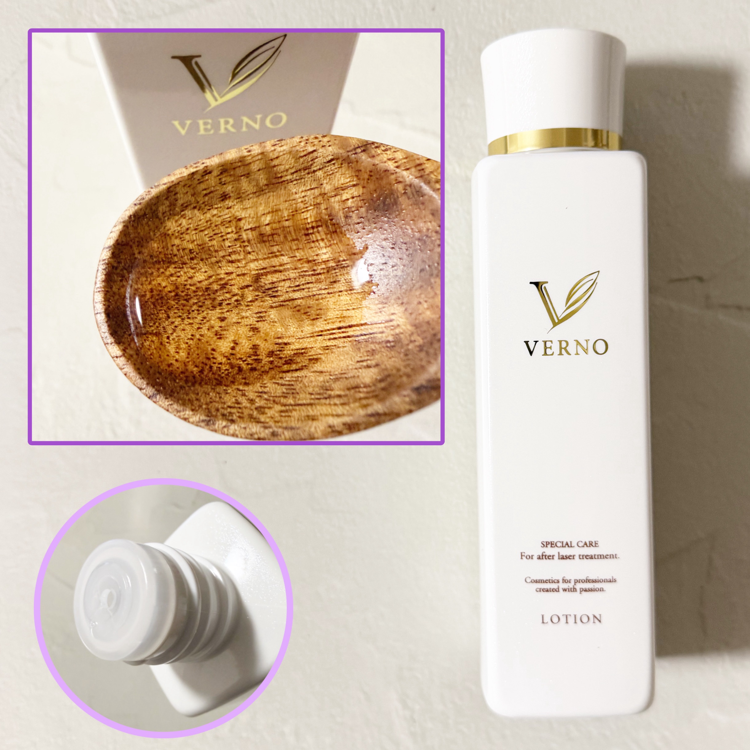 VERNO SKIN ローション〈医薬部外品〉/VERNO SKIN CARE/化粧水を使ったクチコミ（3枚目）