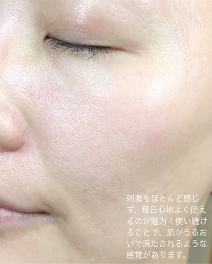 PURPLE PURE SERUM/CHARVIN/美容液を使ったクチコミ(4枚目)