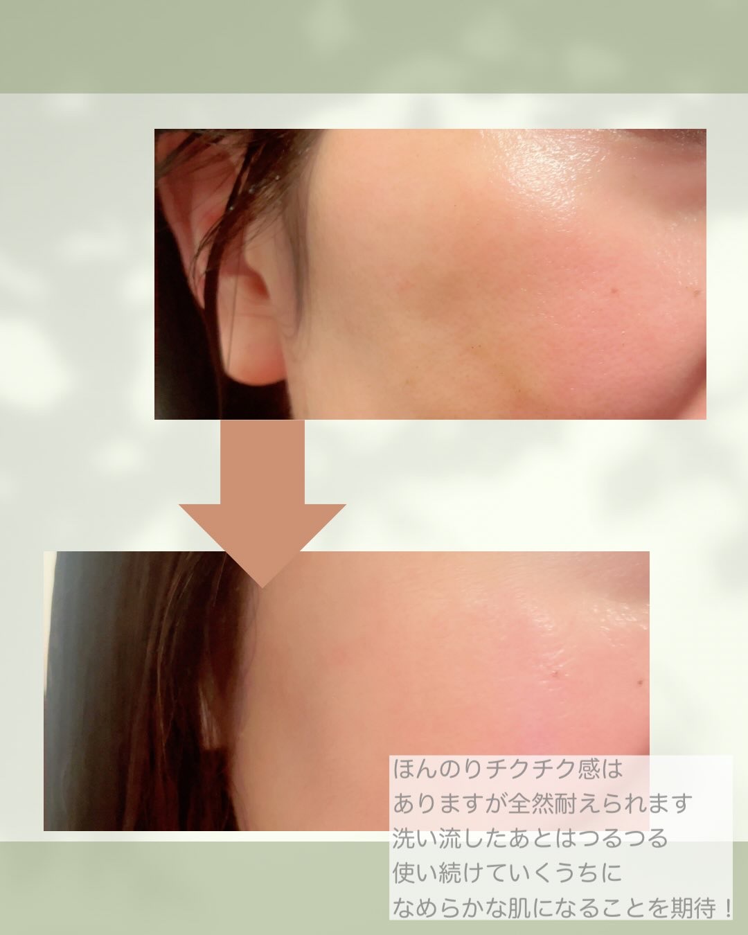 ハーブピーリング/on:myskin/ピーリングを使ったクチコミ（3枚目）