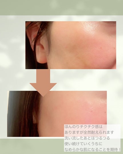 ハーブピーリング/on:myskin/ピーリングを使ったクチコミ(3枚目)