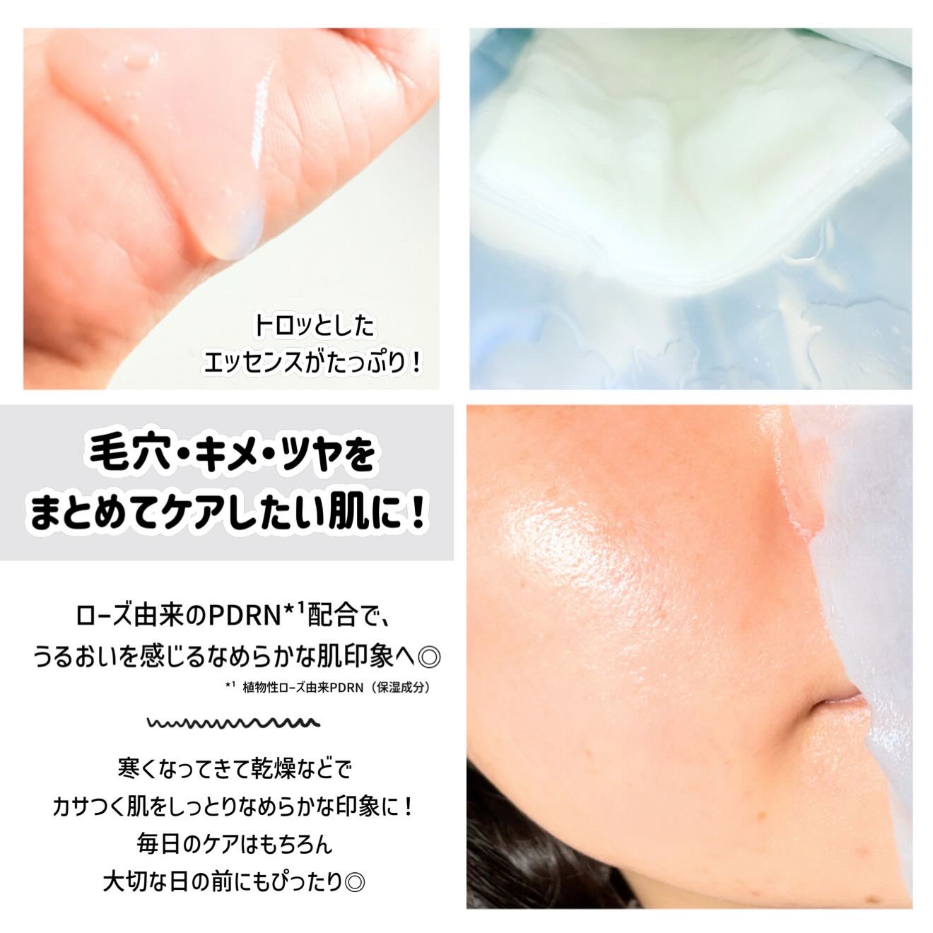 ローゼPDRNエッセンシャルマスクヘルシーグロウ 4枚入り/MEDIHEAL/シートマスク・パックを使ったクチコミ（2枚目）