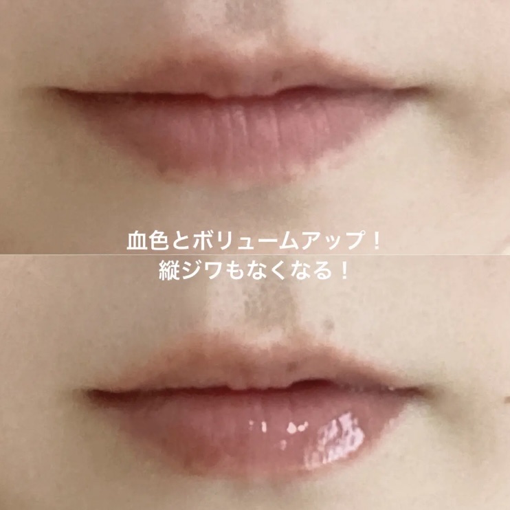 ボリュームリッププランパー/BANILA CO/リッププランパーを使ったクチコミ（3枚目）