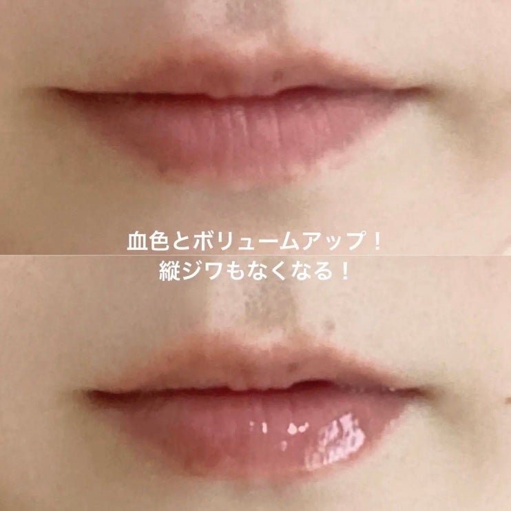 ボリュームリッププランパー/BANILA CO/リッププランパーを使ったクチコミ(3枚目)