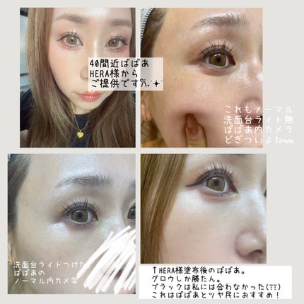 RXザ・アルファアルブチン2 ニキビ跡ケアセラム/COSRX/美容液を使ったクチコミ(9枚目)