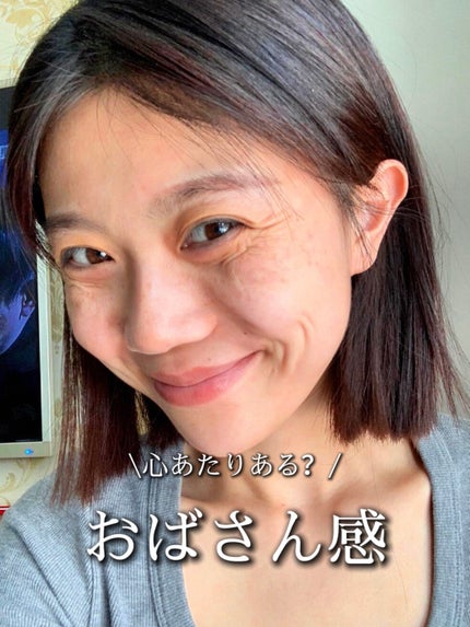 アネトス アクネケア トリートメント セラム/Anetos/美容液を使ったクチコミ(1枚目)