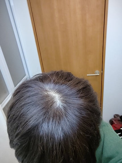 泡カラー/リーゼ/ヘアカラーを使ったクチコミ(2枚目)