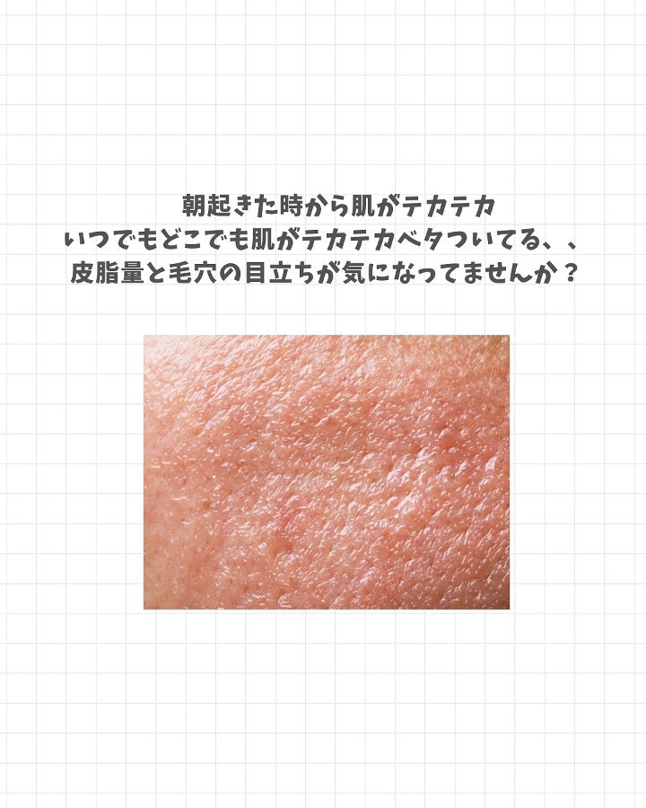 アネトス バランシング トリートメントクリーム/Anetos/フェイスクリームを使ったクチコミ(2枚目)