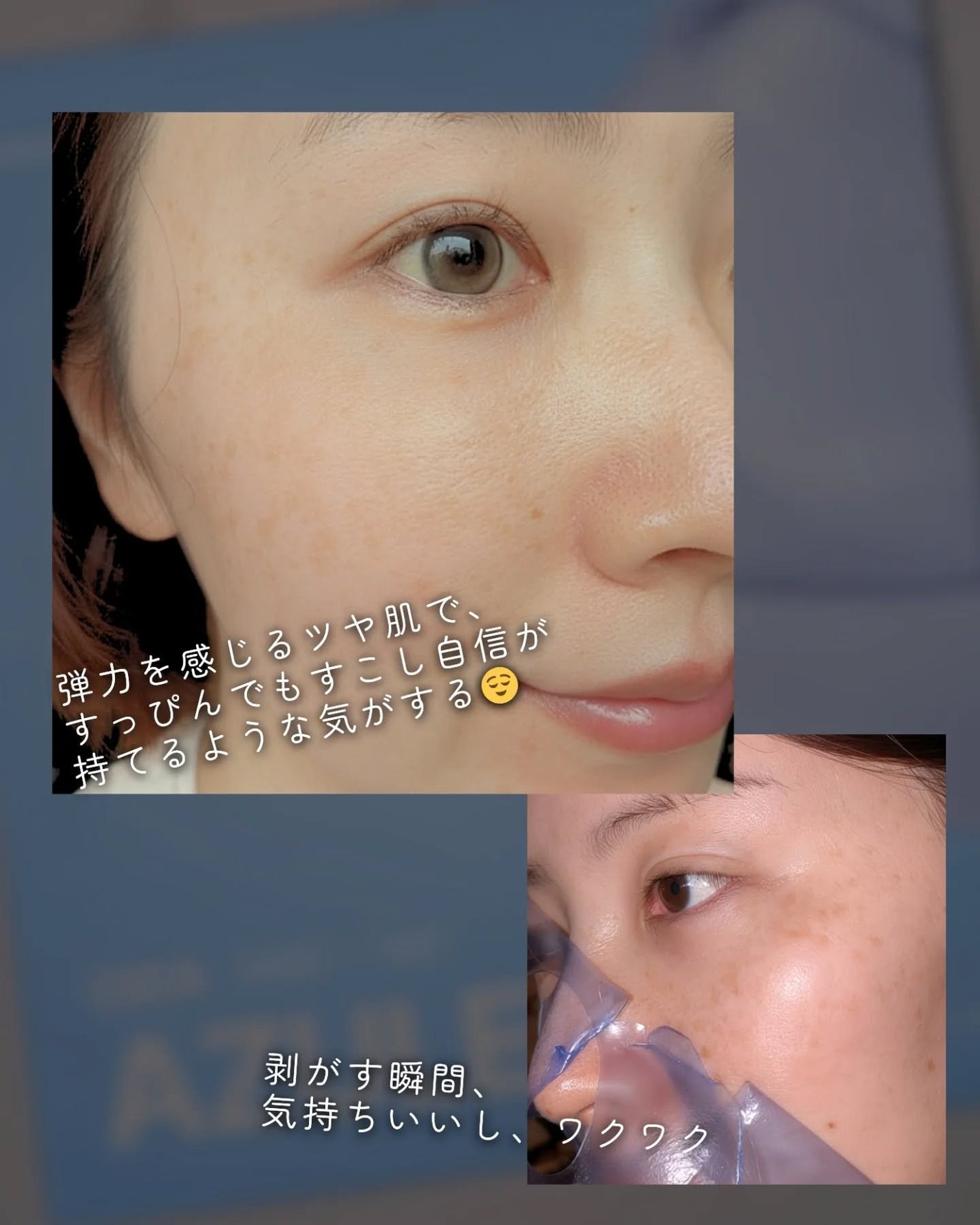 アズレンシカカーミングマスク/from medi+/シートマスク・パックを使ったクチコミ(5枚目)