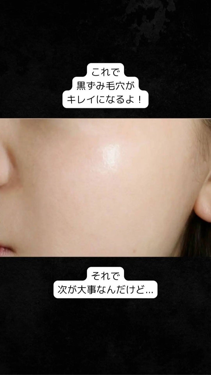 アネトス アクネケア トリートメント セラム/Anetos/美容液を使ったクチコミ(8枚目)