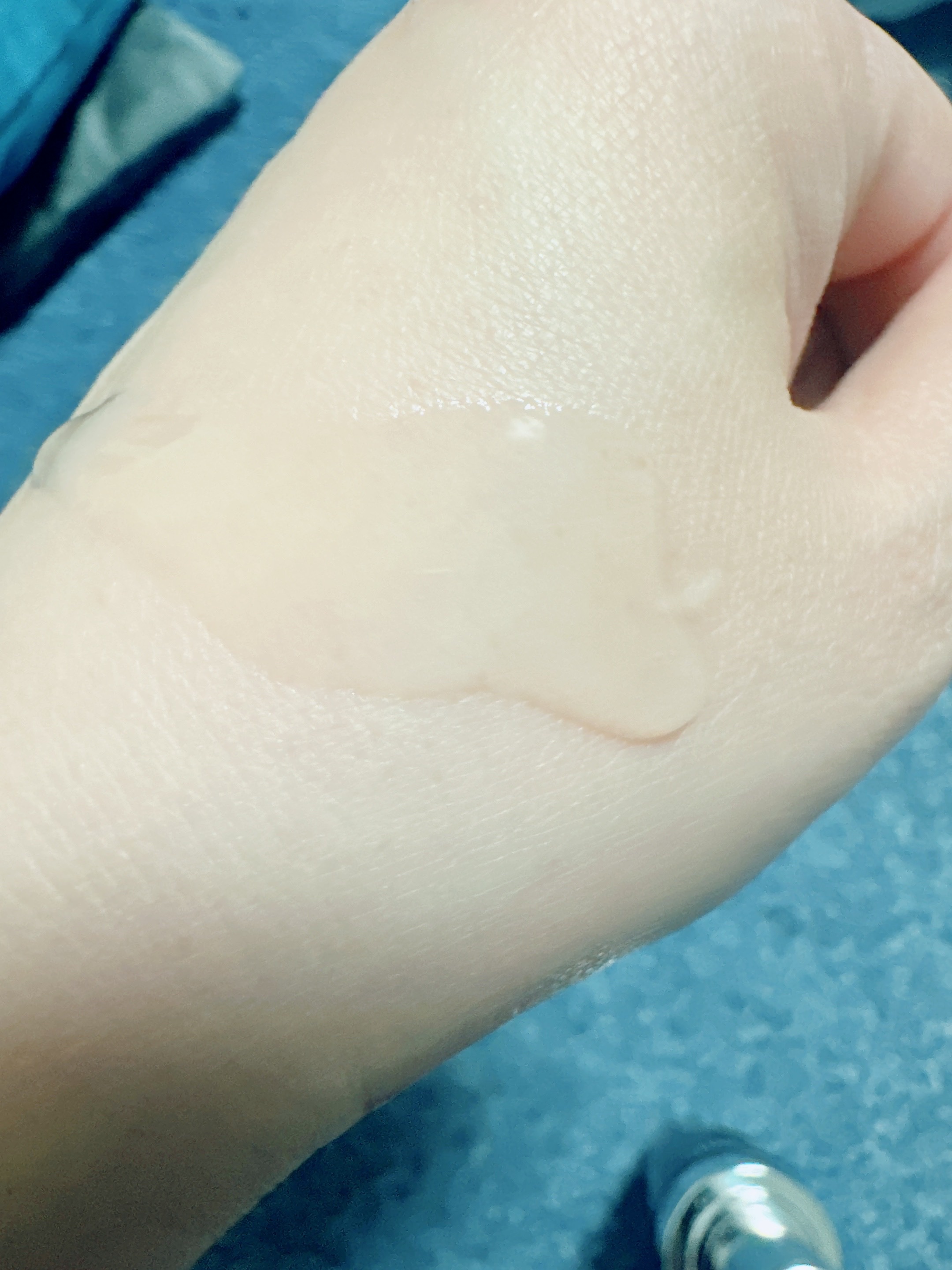 ジェニフィック アルティメ セラム/LANCOME/美容液を使ったクチコミ（3枚目）