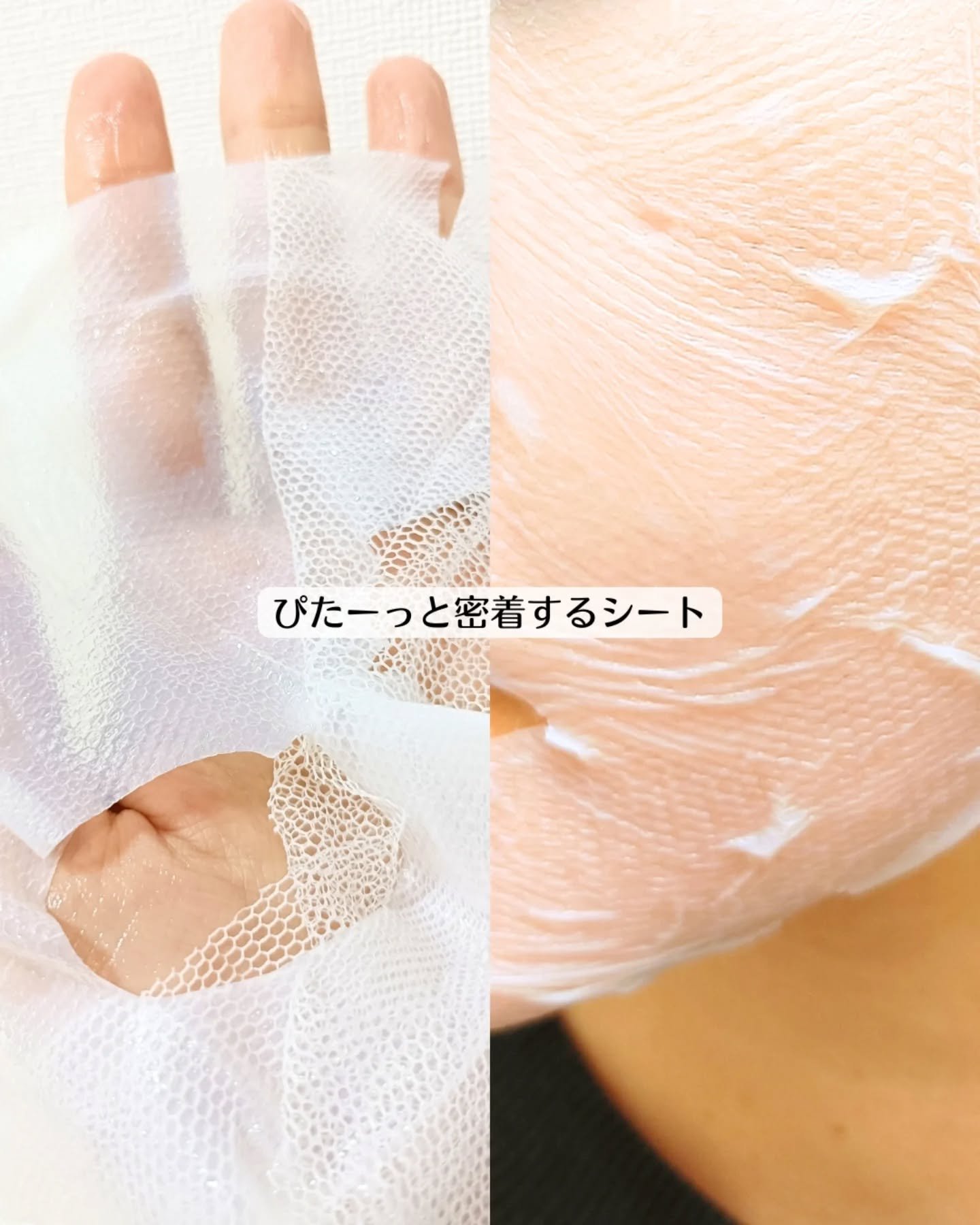 トラブルパッチマスク/EIOM/その他スキンケアを使ったクチコミ（3枚目）