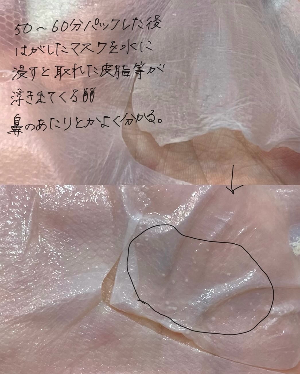 トラブルパッチマスク/EIOM/その他スキンケアを使ったクチコミ（2枚目）